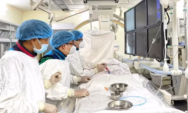 Đột quỵ sau giác hơi
