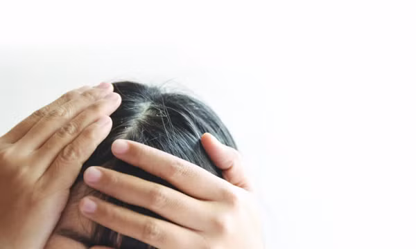 Tự nhuộm tóc bạc coi chừng rước họa