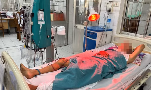 Ngộ độc rượu tại đám tang khiến 1 người tử vong, 5 người cấp cứu: Thêm nạn nhân nhập viện lọc máu