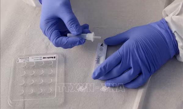 Phát hiện mới giúp chẩn đoán bệnh COVID-19 qua xét nghiệm máu