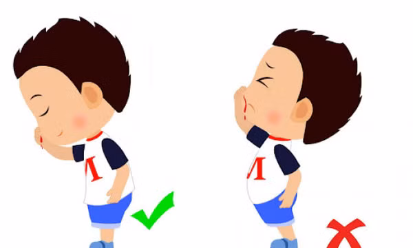 Chảy máu cam ở trẻ gia tăng khi thời tiết hanh khô và cách xử trí