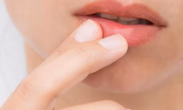 Cấp cứu đôi môi nứt nẻ mùa hanh khô