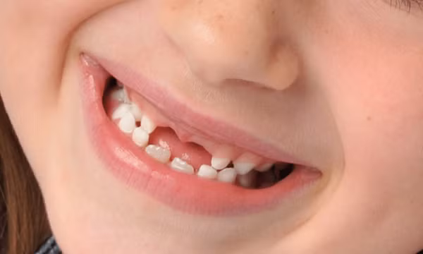 Bác sĩ chỉ rõ 7 bệnh răng miệng thường gặp nhất, phòng ngừa ra sao?