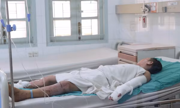 Nhiều học sinh bị đa chấn thương nặng do chơi pháo nổ tự chế 
