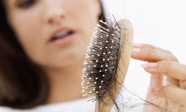Làm thế nào để tránh rụng tóc nhiều trong mùa đông?