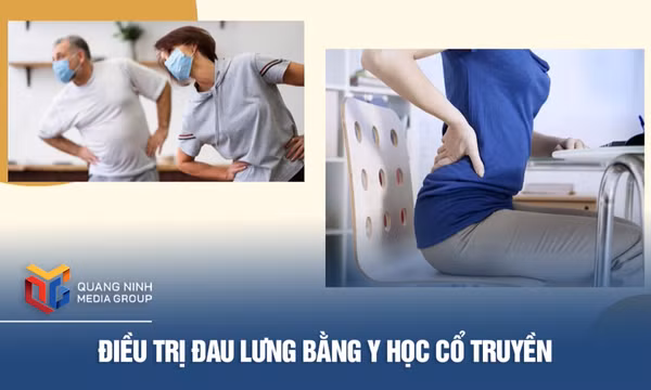 Điều trị đau lưng bằng y học cổ truyền