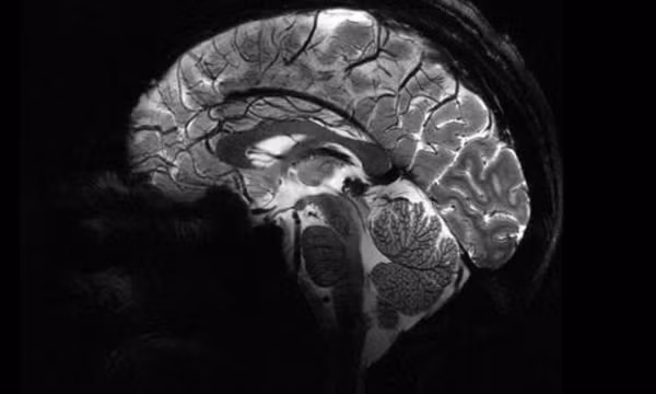Hình ảnh rõ nét nhất về bộ não chúng ta từ siêu máy quét MRI