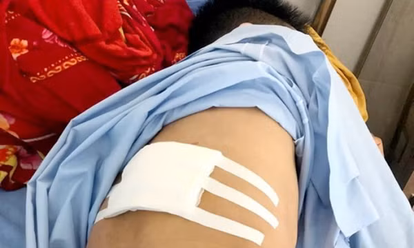 Đi bán lá giang, nam thanh niên bị kẻ bịt mặt chém nhập viện
