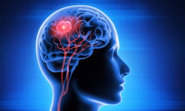 Đã tìm ra liệu pháp ngừa ung thư tái phát