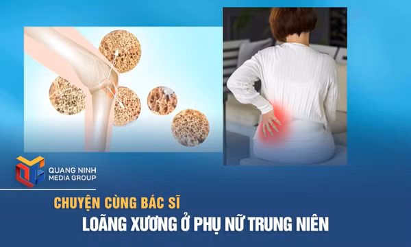 Loãng xương ở phụ nữ trung niên