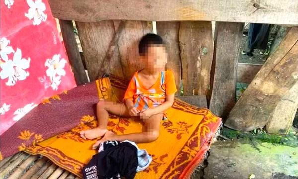 Bé 5 tuổi có nhiều vết thương bị đưa ra ở riêng trong lán tạm