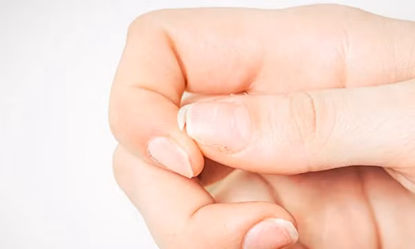 5 dấu hiệu bất thường ở móng tay báo hiệu tình trạng sức khỏe