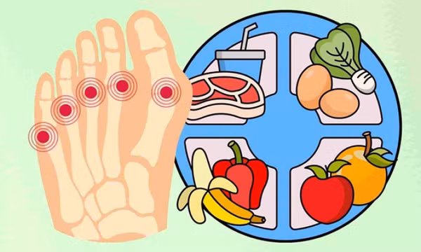 10 cách giảm axit uric tự nhiên tại nhà an toàn
