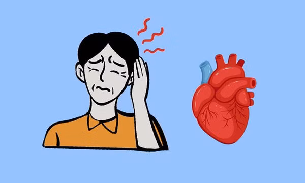 Đau nửa đầu và nguy cơ mắc bệnh tim mạch