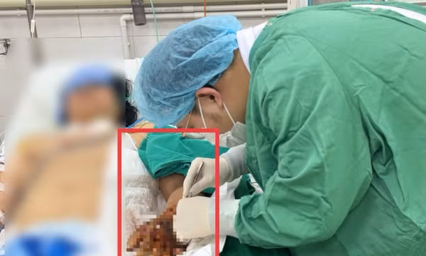 Người phụ nữ nguy kịch sau khi tiêm thuốc ở phòng khám tư