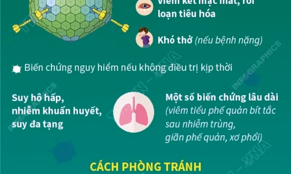 Không xét nghiệm tràn lan Adenovirus ở trẻ em