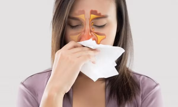 Ngạt mũi buổi sáng dùng thuốc gì?