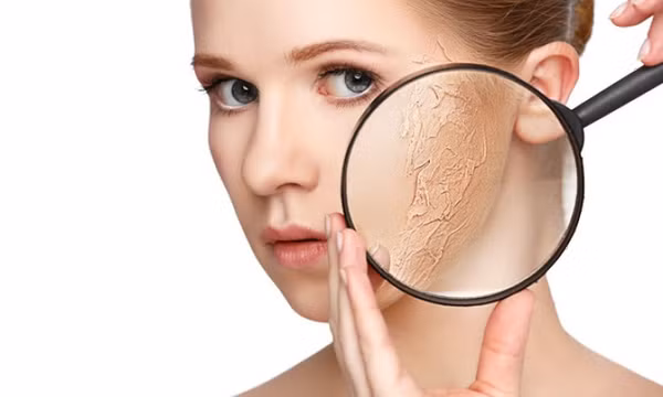  7 cách hạn chế bong tróc da khi thời tiết hanh khô