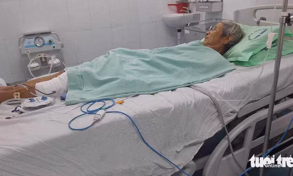 Bầy khỉ hung hãn cắn 3 người bị thương, cắn chết 4 con chó