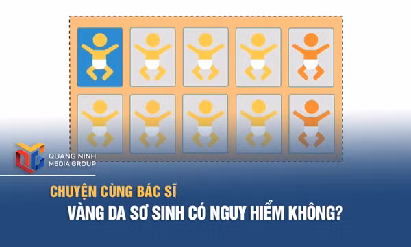 Vàng da sơ sinh có nguy hiểm không?