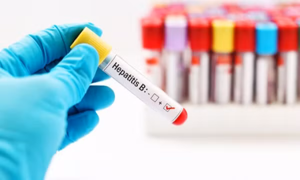 Các thuốc kháng virus trị viêm gan B, những bất lợi cần lưu ý