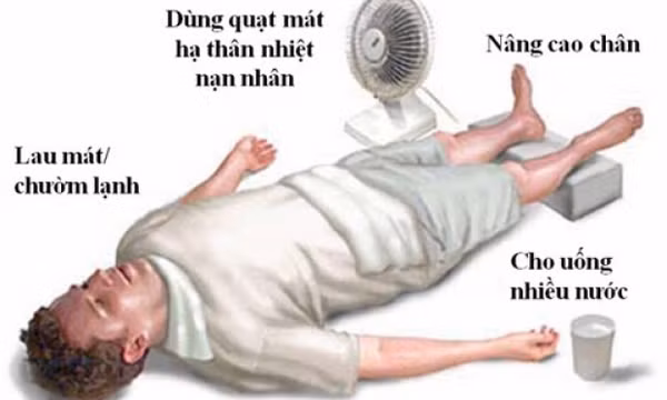 Xử trí khi bị say nắng ngày hè 