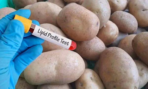 3 loại thực phẩm chay có thể gây tăng lipid máu