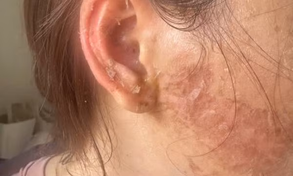 Một phụ nữ ở Cà Mau tố bị bắt cóc, đánh đập, xăm mặt và tạt axit