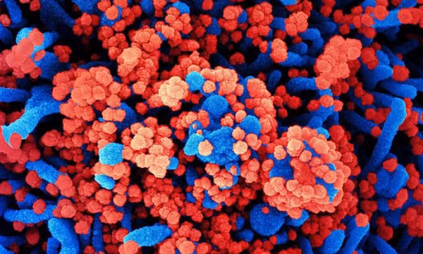 Nga lên tiếng về loại virus chưa xác định gây ra tình trạng ho ra máu