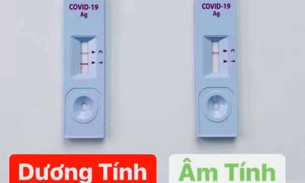  Hướng dẫn lấy mẫu, thực hiện test nhanh SARS-CoV-2 tại nhà