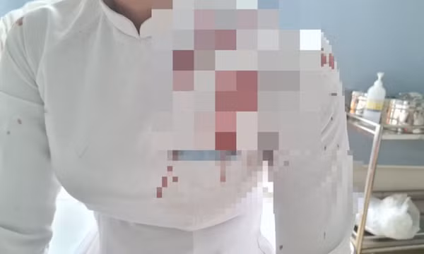 Nữ sinh ở Đắk Lắk dùng guốc đánh vào đầu bạn cùng lớp gây thương tích nặng