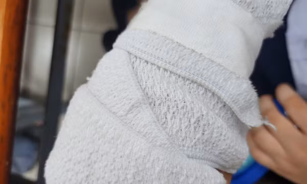 Đình chỉ giáo viên đánh học sinh gãy ngón tay