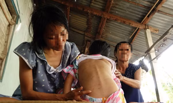 Bắt thanh niên đánh đập hai mẹ con ‘vợ hờ’ tàn bạo