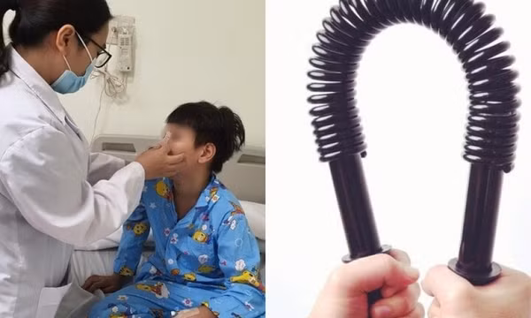Bé trai vỡ mũi sau thử thách bẻ 'đồ long đao' 30 kg