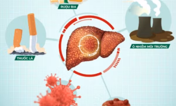 Cẩn thận hỏng gan vì thải độc