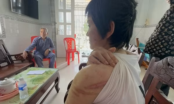Người chồng bị tố bạo hành vợ bầu 7 tháng như thời trung cổ khai gì?