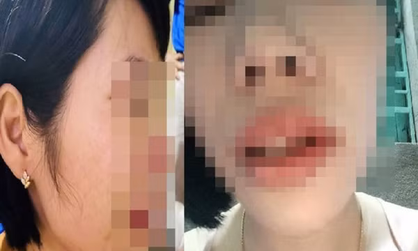Chỉ đạo khẩn vụ phụ huynh xông vào nhà đánh cô giáo vì con bị hạnh kiểm trung bình