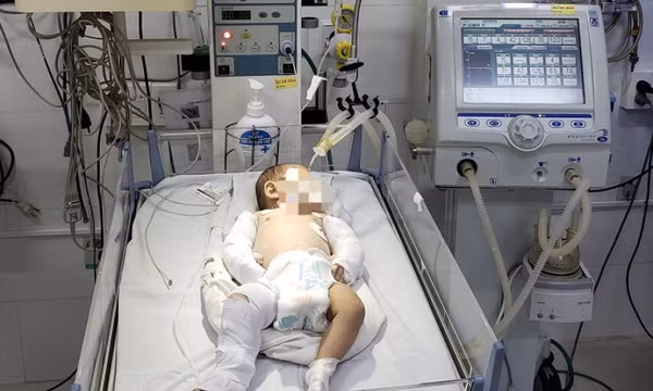 Bé gái hơn 2 tháng tuổi bị bạo hành dã man được xuất viện