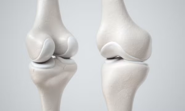 Phát triển sụn khớp nhân tạo có tính ứng dụng cao