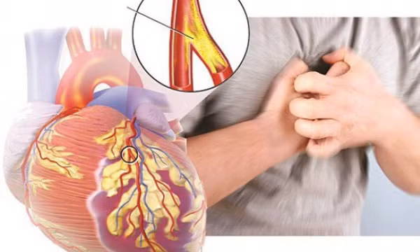 Một số lưu ý khi dùng thuốc điều trị triệu chứng suy tim