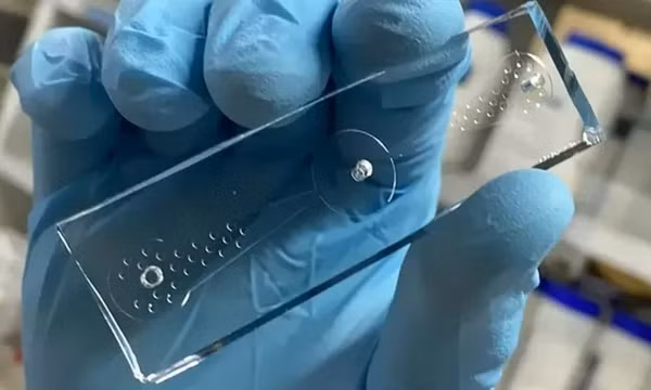 Có thể phát hiện ung thư phổi bằng 1 con chip chứa đầy... giun