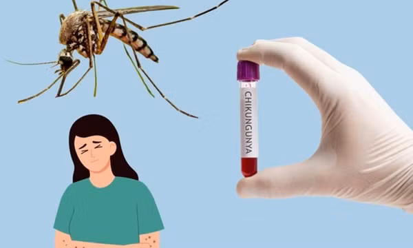 Bộ Y tế bác tin Việt Nam ghi nhận ca mắc bệnh Chikungunya