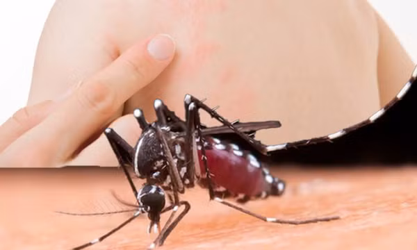 Những biện pháp hiệu quả để tránh muỗi trong thời tiết mưa nhiều