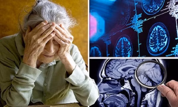 Hướng đi mới trong cuộc chiến chống bệnh Alzheimer
