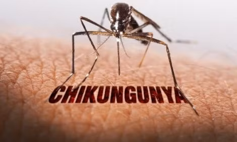 Trung Quốc phát hiện thêm các ca bệnh Chikungunya