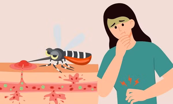 Những triệu chứng cảnh báo bệnh chikungunya bạn không nên bỏ qua