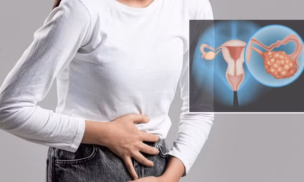 Phát hiện mới giúp cải thiện khả năng chẩn đoán và điều trị ung thư buồng trứng