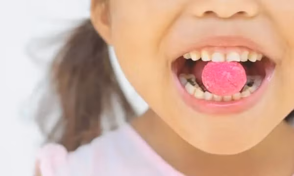 7 loại thực phẩm làm tăng nguy cơ sâu răng bạn nên biết để tránh