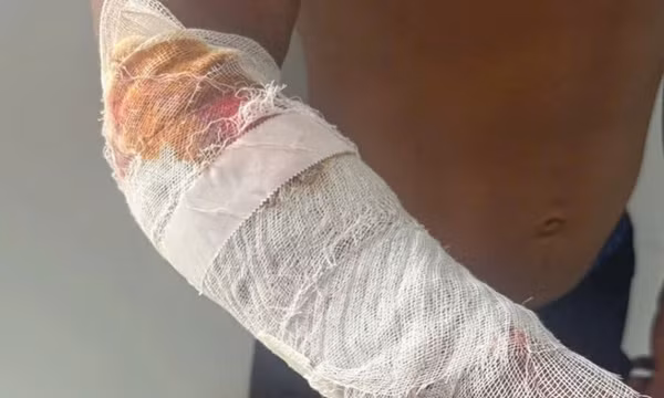 Cá sấu của khu du lịch sổng chuồng, cắn người dân bên sông