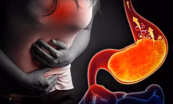 Biến chứng nguy hiểm của bệnh trào ngược dạ dày thực quản